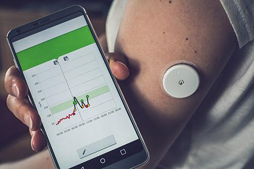 How to get the most out of your Expert CGM Insight Experience