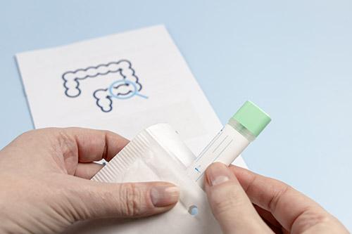 Can a FIT test detect bowel cancer?
