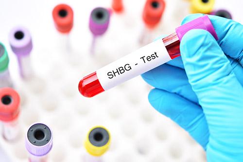 What is sex hormone binding globulin?