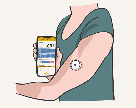 Using a Continuous Glucose Monitor
