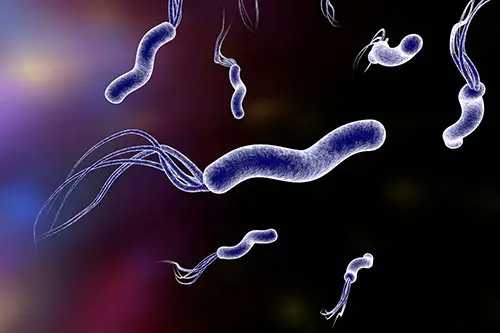 Do I need a stool test for Helicobacter pylori?