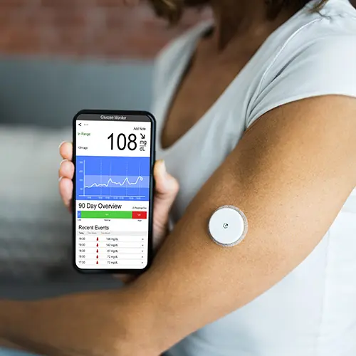 Using a Continuous Glucose Monitor